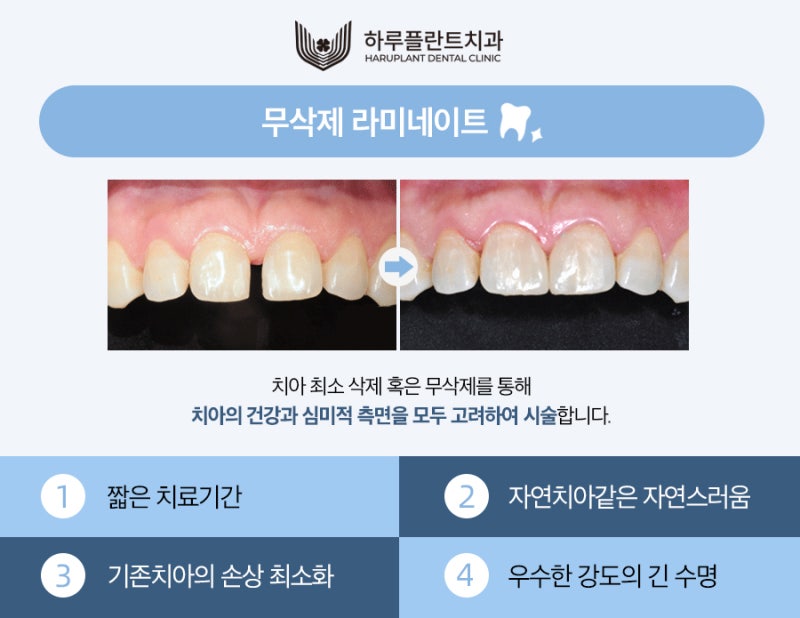 강남 하루플란트치과 라미네이트 후회하지않으려면 사진 3