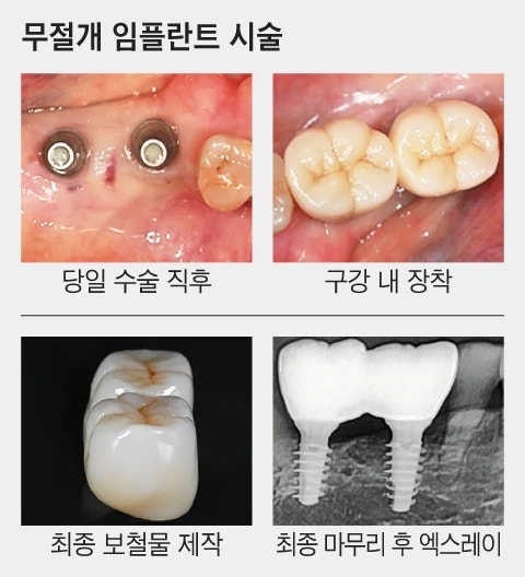 강남역치과 언론이 주목하는 하루플란트치과 변성만 대표원장 사진 10