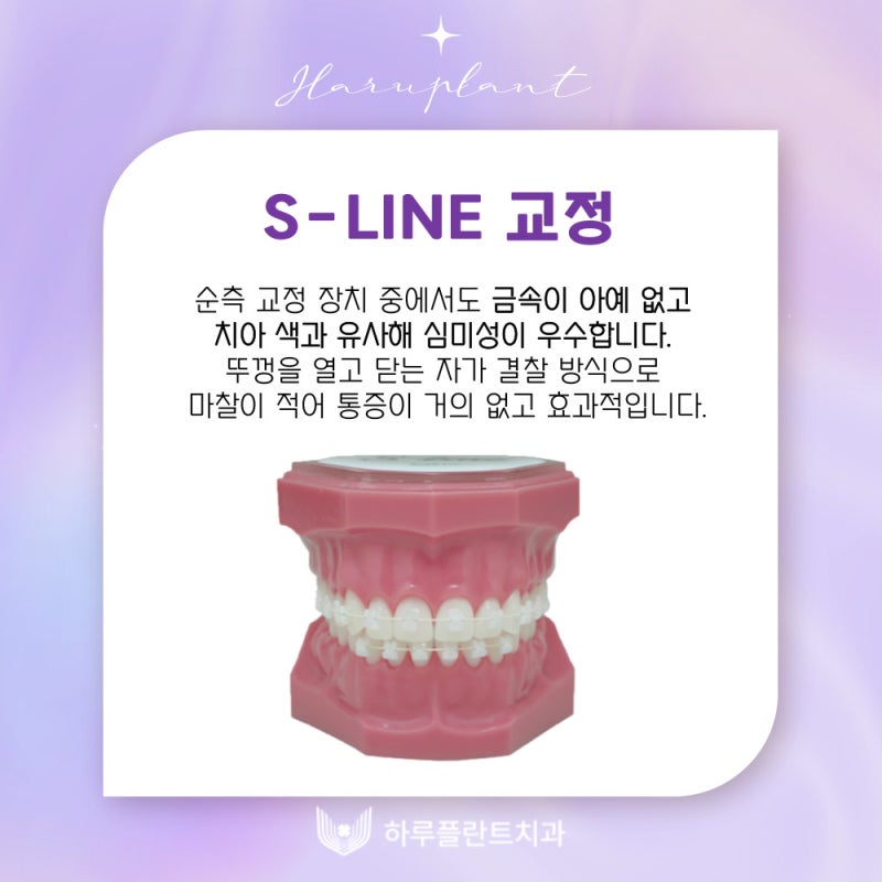 강남역치과 하루플란트치과 치아교정 개인별 맞춤 교정으로 사진 6