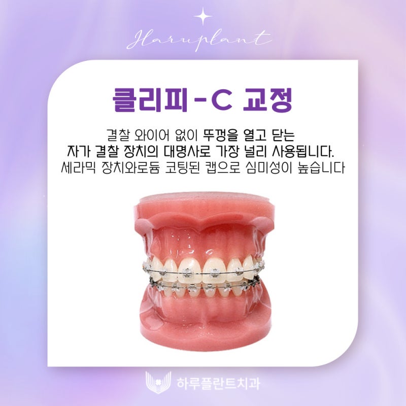 강남역치과 하루플란트치과 치아교정 개인별 맞춤 교정으로 사진 10