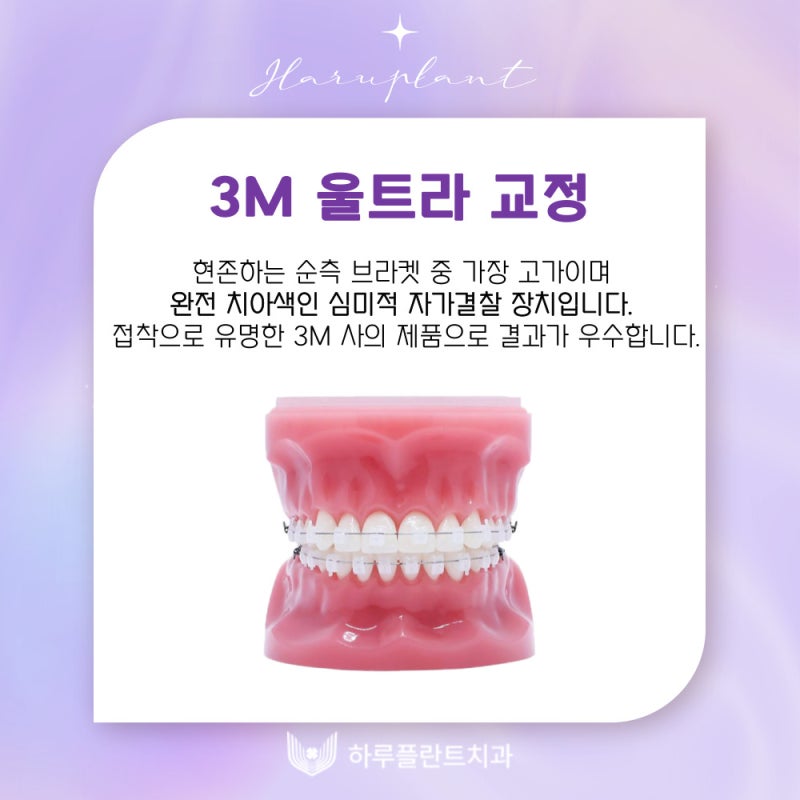 강남역치과 하루플란트치과 치아교정 개인별 맞춤 교정으로 사진 4
