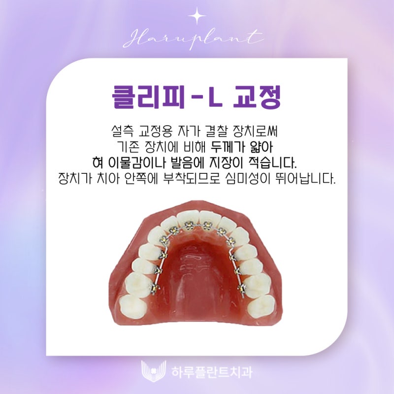 강남역치과 하루플란트치과 치아교정 개인별 맞춤 교정으로 사진 8