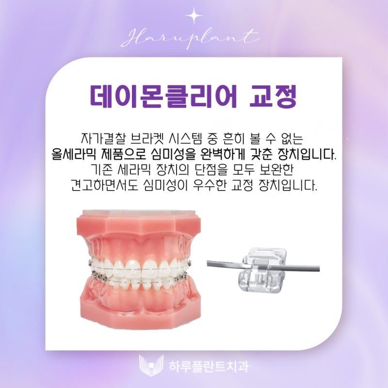 강남역치과 하루플란트치과 치아교정 개인별 맞춤 교정으로