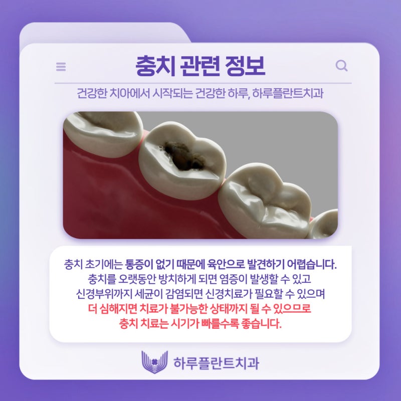 강남역치과 하루플란트치과 충치치료 미루고있다면 사진 2