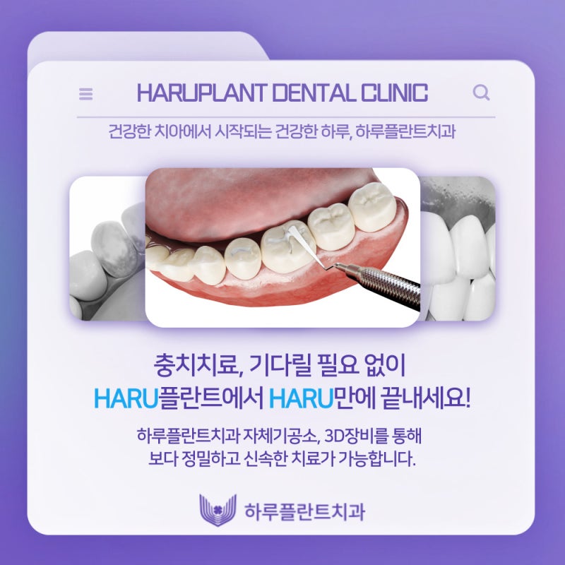 강남역치과 하루플란트치과 충치치료 미루고있다면 사진 8
