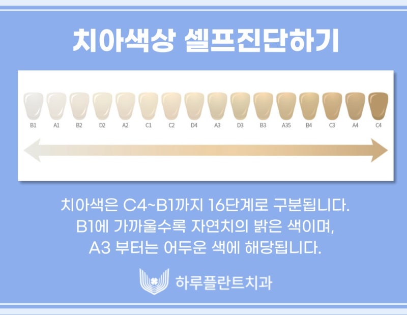 강남치과 하루플란트치과 치아미백 고민중이라면 사진 6