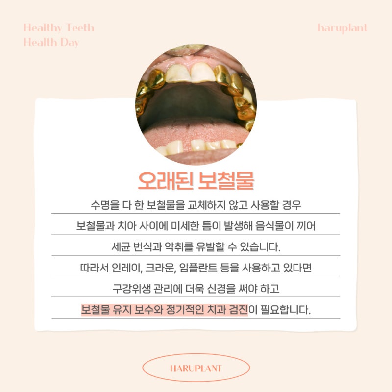 강남역 하루플란트치과 양치 후에도 사라지지 않는 입냄새 원인은 사진 5