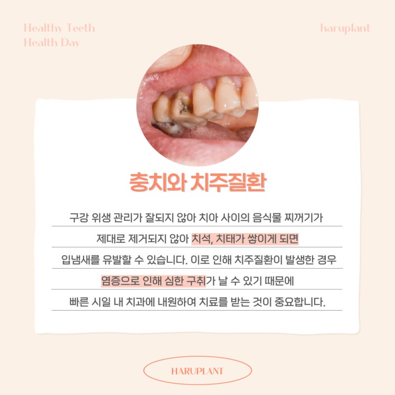 강남역 하루플란트치과 양치 후에도 사라지지 않는 입냄새 원인은 사진 4