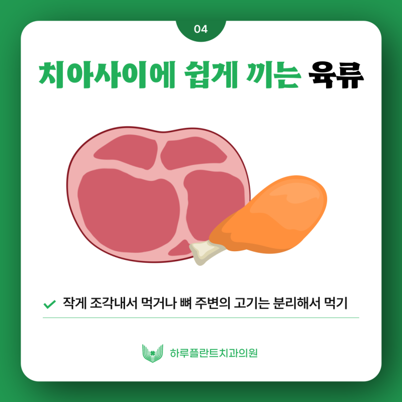 [HARU치과상식] 치아교정시 피해야하는 음식은? 사진 5
