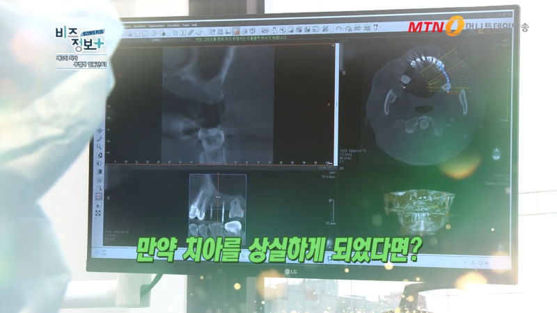 하루플란트치과 변성만 대표원장 MTN 신영일의 비즈정보 플러스 출연 사진 7