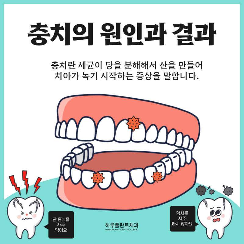 [HARU치과상식] 치아관리로 건강하게 치아지키기 사진 3