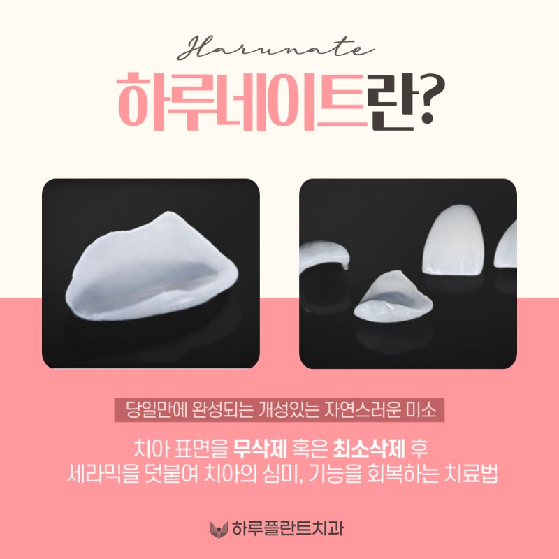 강남역 하루플란트치과 당일 완성 라미네이트 <하루네이트>