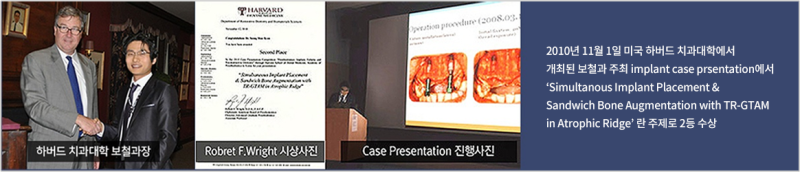 하루플란트치과 변성만 대표원장 무절개 임플란트 세미나 사진 3