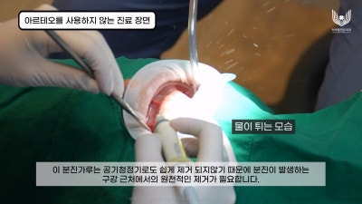 서초구치과 감염예방을 위한 최점단 아르테오 설치 하루플란트치과