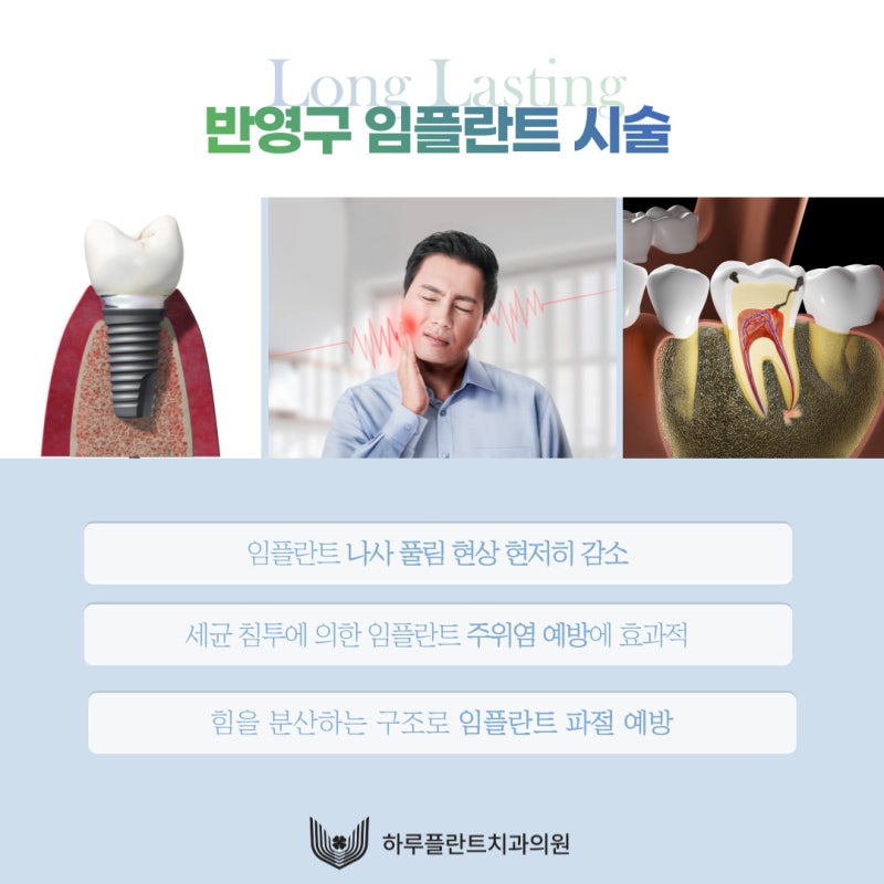 통증 줄이고 회복 빠른 하루플란트치과 CLS 무절개 임플란트 사진 4
