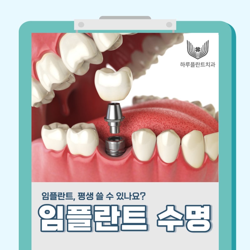 임플란트 평생 쓸 수 있나요? 오래 쓰는 방법 대공개(무절개 임플란트 수명)