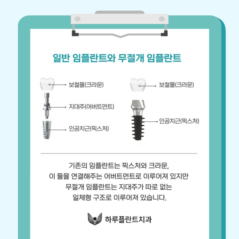 임플란트 평생 쓸 수 있나요? 오래 쓰는 방법 대공개(무절개 임플란트 수명)