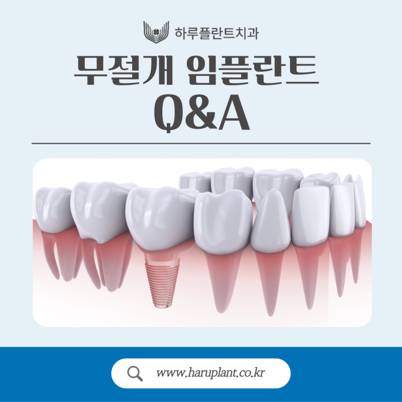 무절개 임플란트 수술 과정, 장점, 부작용까지