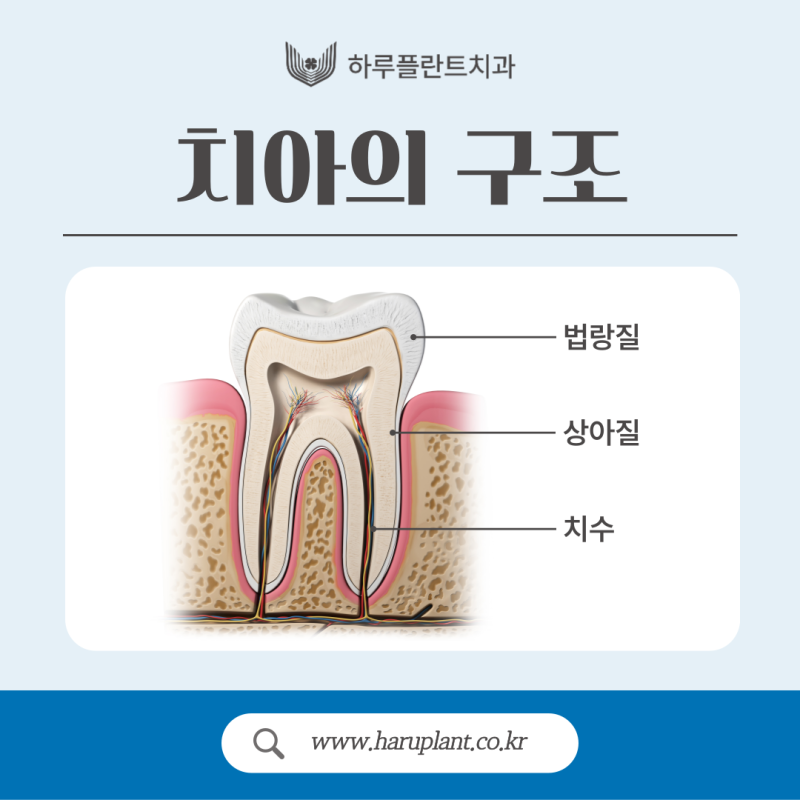 강남충치치료 레진 인레이 차이는? 사진 2
