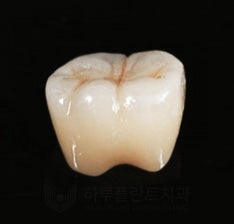 치과당일치료 하루플란트치과의 혁신적인 하루완성 클리닉 사진 16