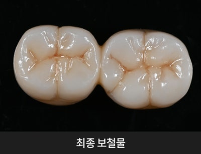 치과당일치료 하루플란트치과의 혁신적인 하루완성 클리닉 사진 4