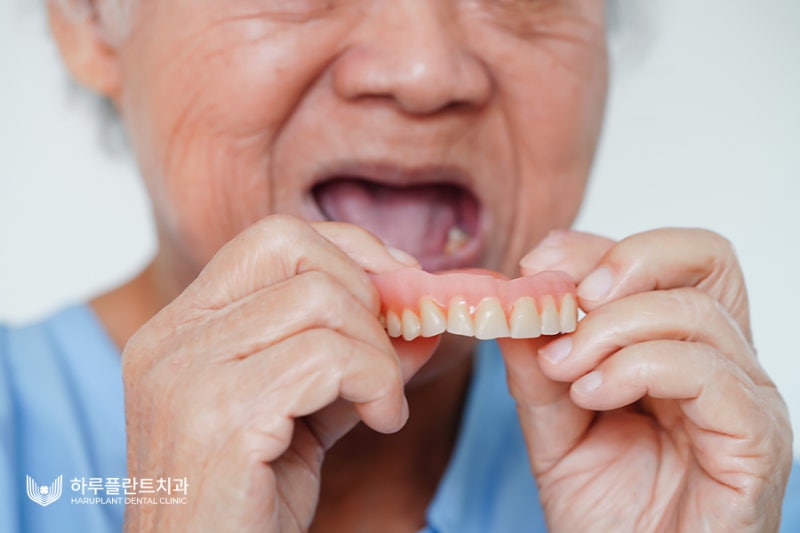 완전틀니가격? 임플란트보다 틀니가 비싼 이유 사진 3