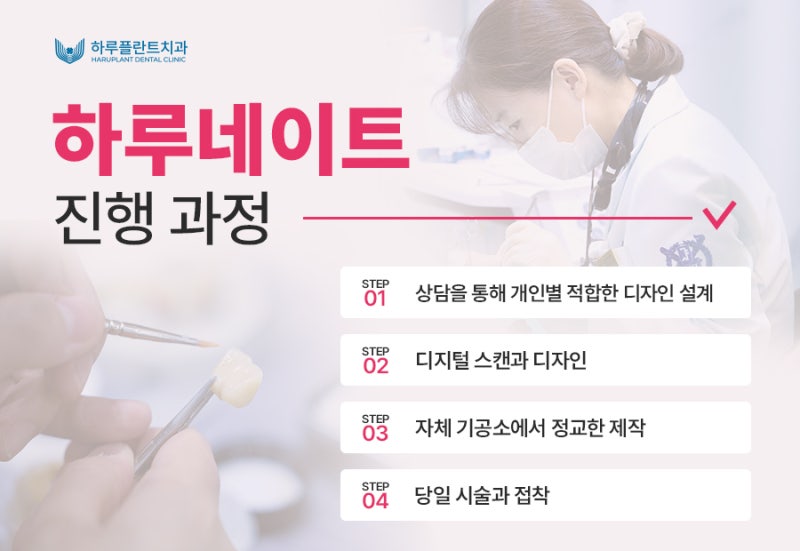 하루 만에 완성하는 자연스러운 심미치료, 하루네이트 사진 6