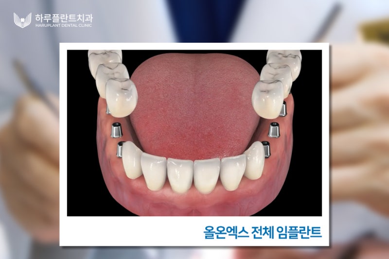 노인 틀니 가격? '이것' 모르면 후회합니다 사진 7