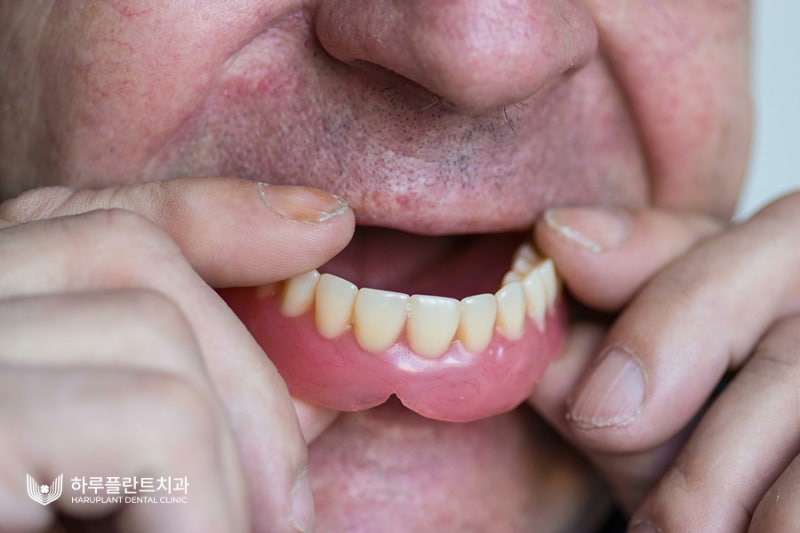노인 틀니 가격? '이것' 모르면 후회합니다 사진 4