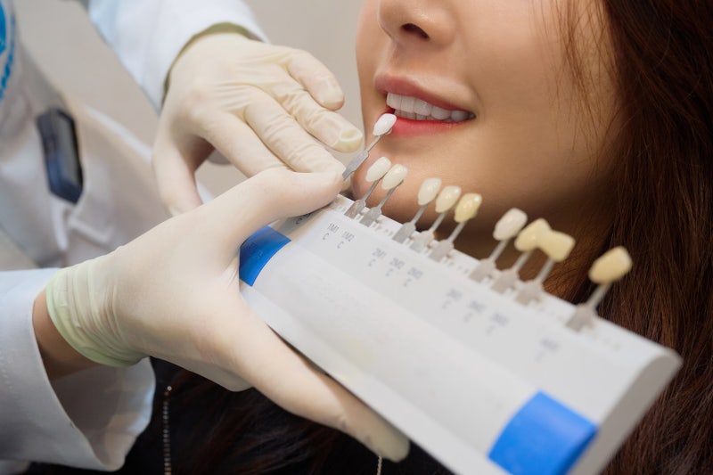 골프선수 문정현 프로 라미네이트, 하루플란트치과에서 매력 업! 사진 6