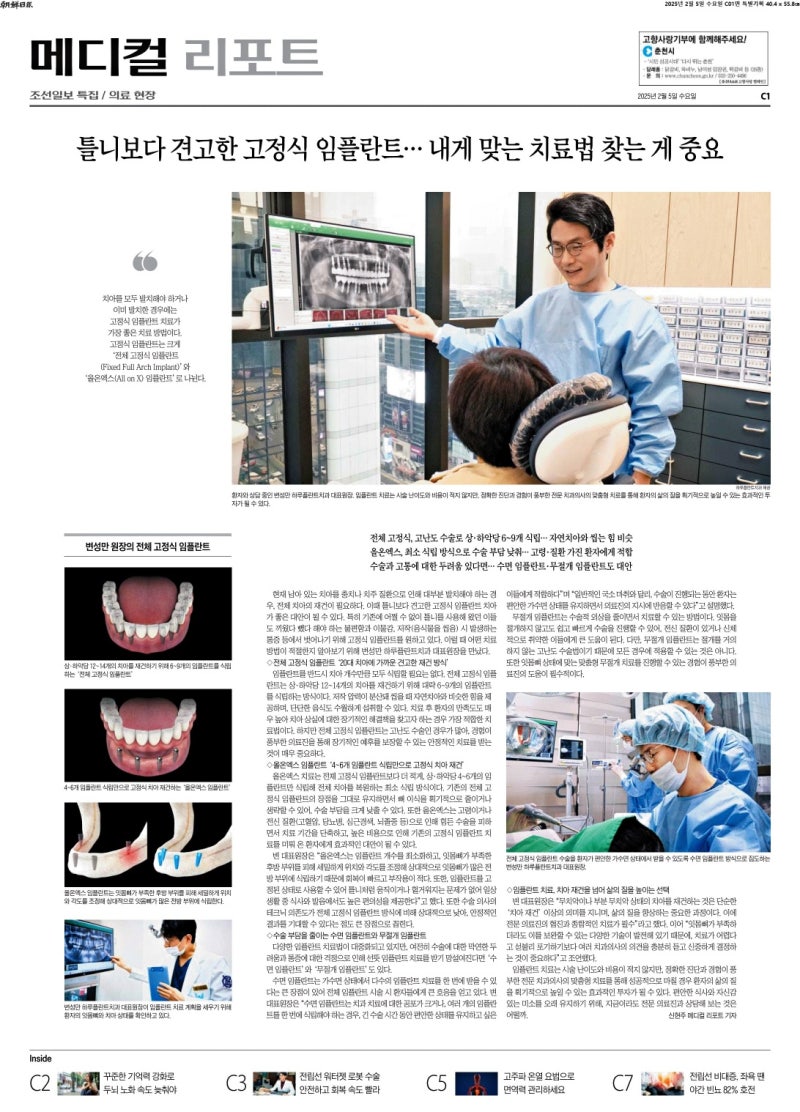 하루플란트치과 변성만 원장 조선일보 소식 <틀니보다 견고한 고정식 임플란트… 내게 맞는 치료법 찾는 게 중요>
