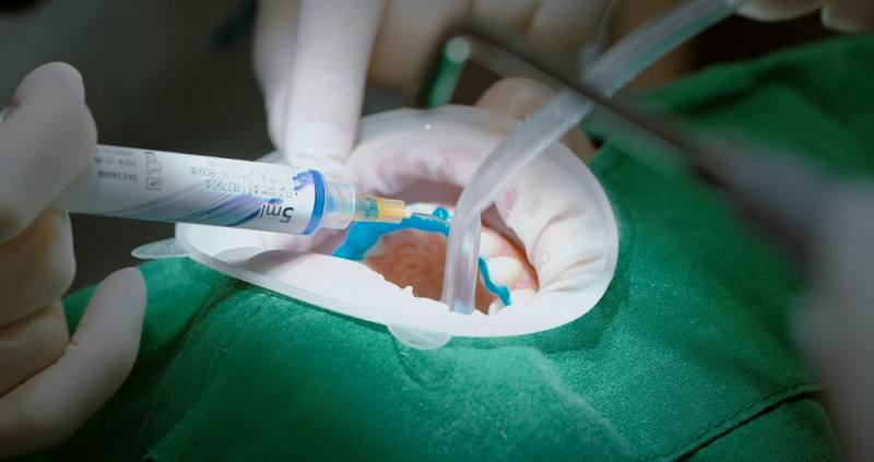 강남역하루플란트치과 하루네이트 라이브, 세계가 주목한 임상 현장의 기록 사진 9