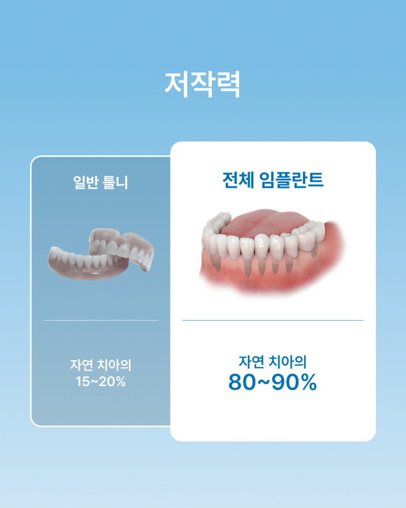 틀니 불편하다면? 꼭 알아야 할 전체 임플란트와 틀니 차이점, 강남 임플란트 하루플란트치과에서 알려드립니다 사진 4
