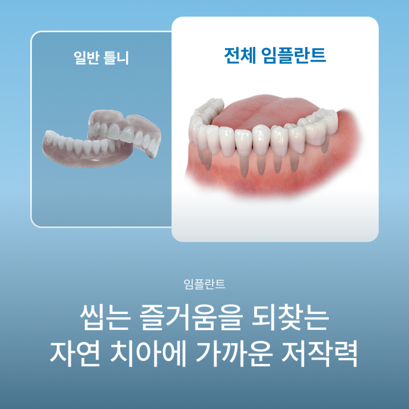 틀니 불편하다면? 꼭 알아야 할 전체 임플란트와 틀니 차이점, 강남 임플란트 하루플란트치과에서 알려드립니다