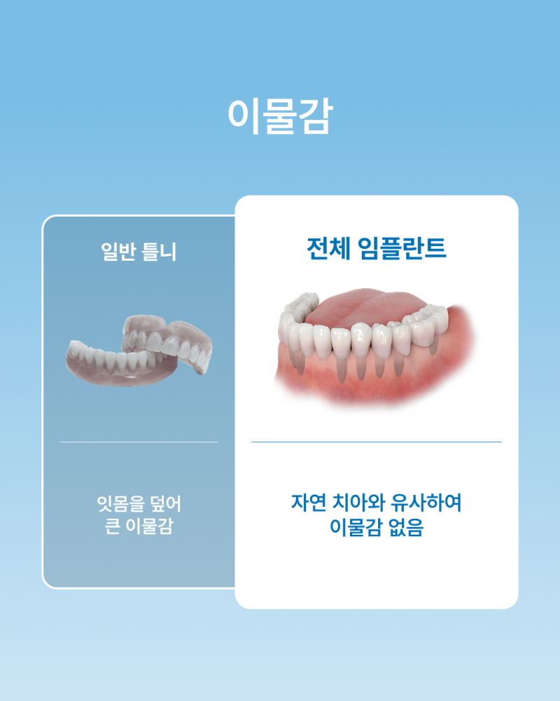 틀니 불편하다면? 꼭 알아야 할 전체 임플란트와 틀니 차이점, 강남 임플란트 하루플란트치과에서 알려드립니다 사진 7