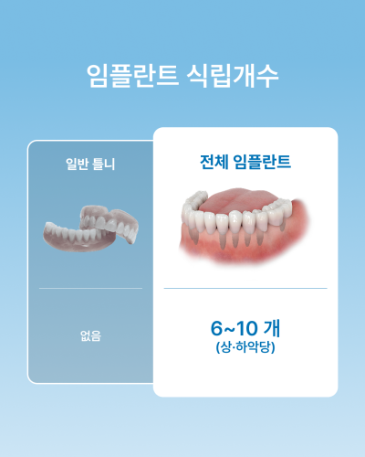 틀니 불편하다면? 꼭 알아야 할 전체 임플란트와 틀니 차이점, 강남 임플란트 하루플란트치과에서 알려드립니다 사진 3