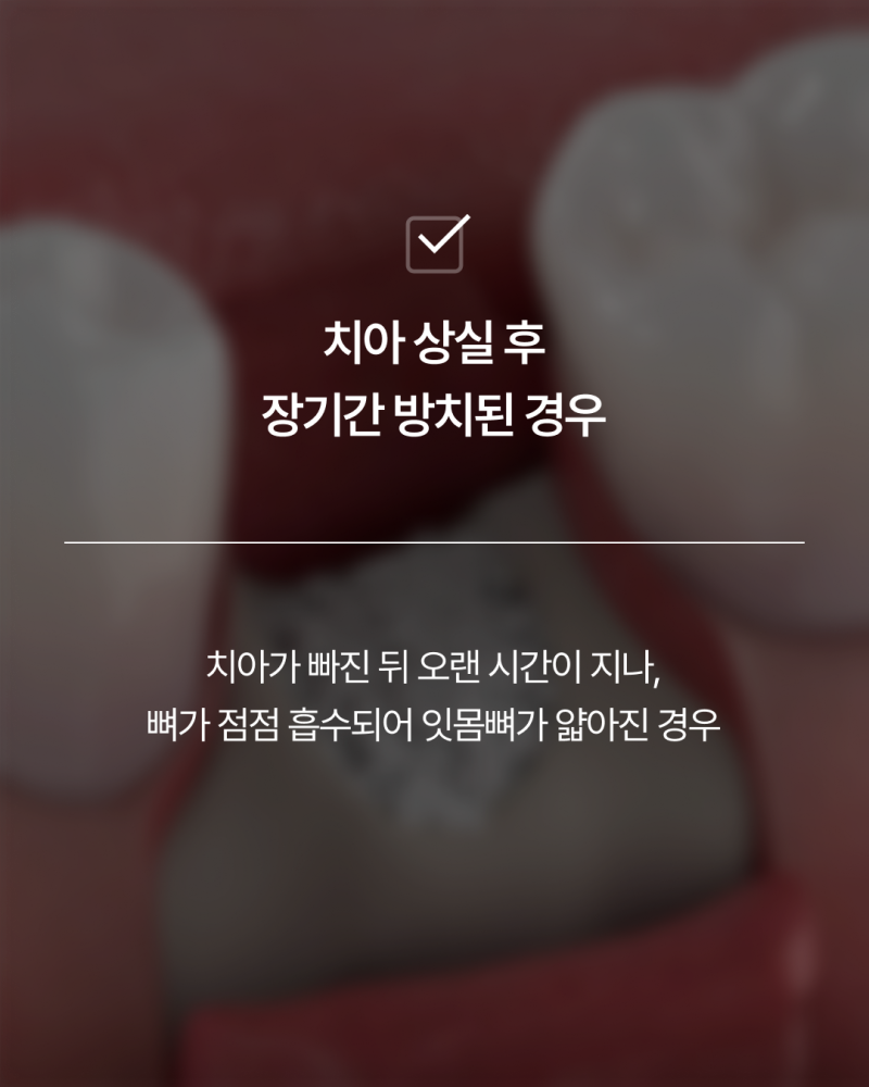 임플란트뼈이식, 반드시 필요할까요? 강남임플란트 하루플란트에서 기준을 확인하세요 사진 5
