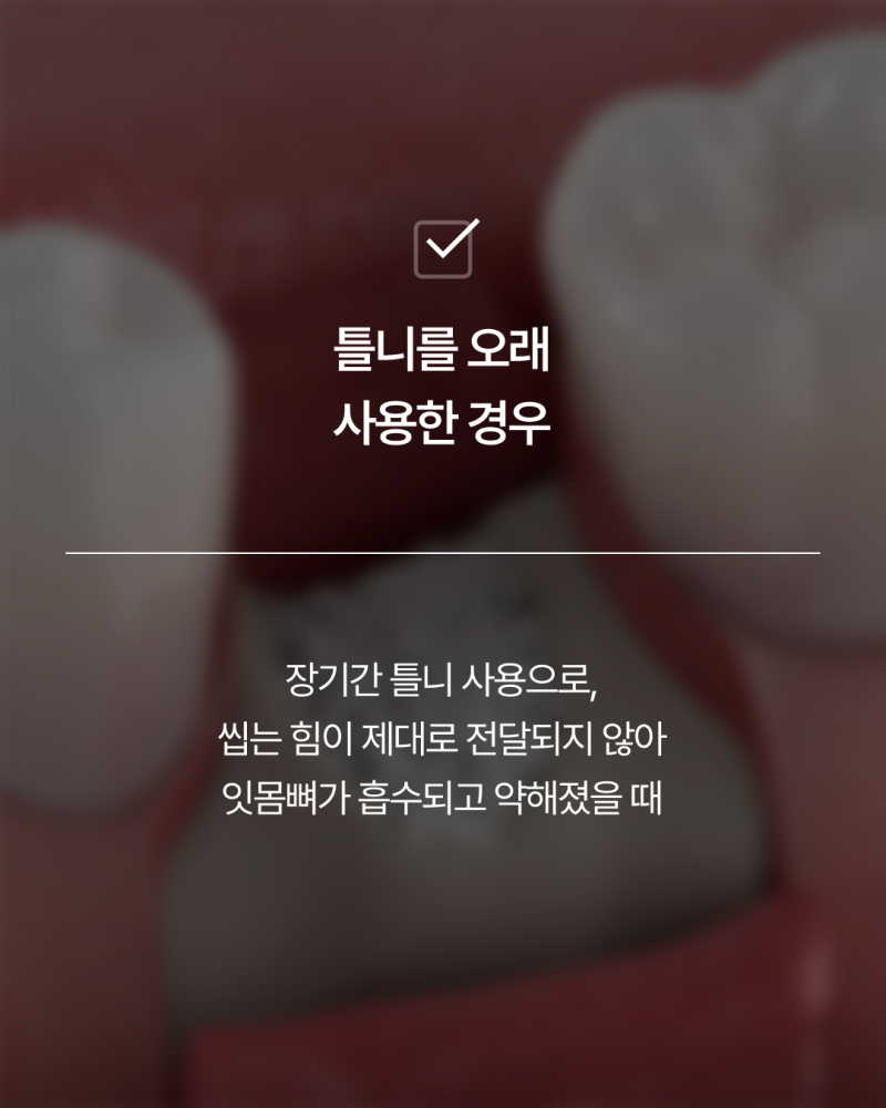 임플란트뼈이식, 반드시 필요할까요? 강남임플란트 하루플란트에서 기준을 확인하세요 사진 7