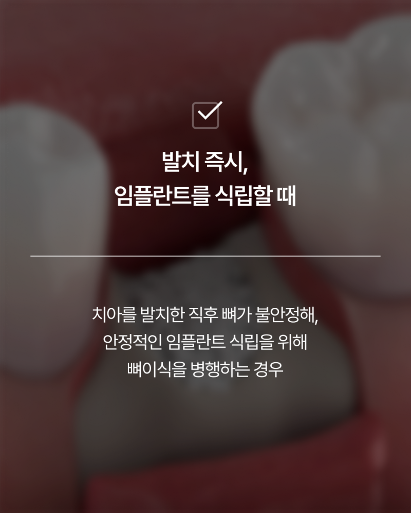 임플란트뼈이식, 반드시 필요할까요? 강남임플란트 하루플란트에서 기준을 확인하세요 사진 3