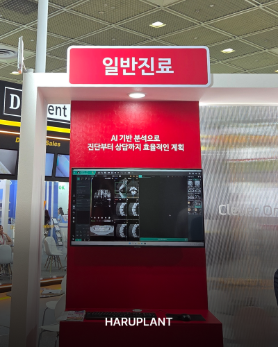 SIDEX 2026, 하루플란트치과 시덱스에서 변화하는 치과 기술과 임상 트렌드를 확인하다 사진 5