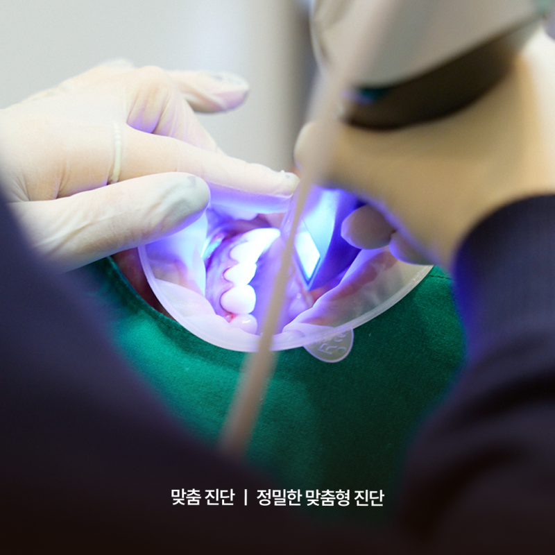 강남역임플란트치과추천 기준, 하루플란트치과 맞춤형 진료 시스템에서 확인하세요