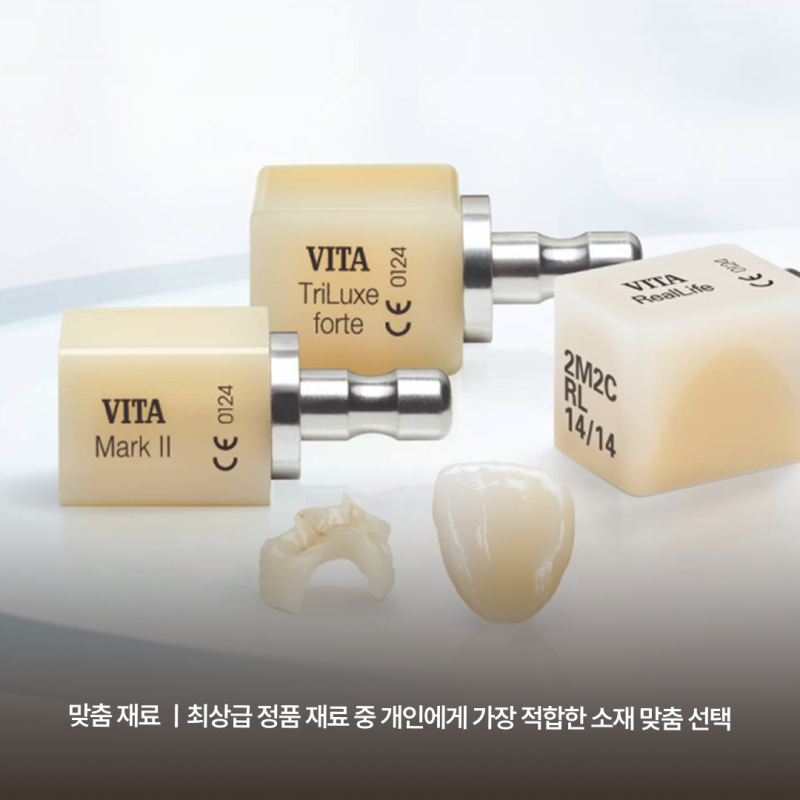 강남역임플란트치과추천 기준, 하루플란트치과 맞춤형 진료 시스템에서 확인하세요 사진 4