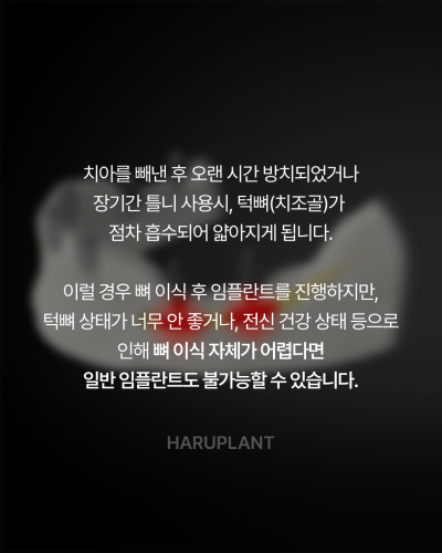 올온엑스 임플란트, 전악 임플란트가 어렵다고 들은 경우에도 고려할 수 있는 이유는? 사진 2