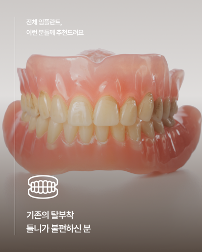 65세이상임플란트 중 무치악에 해당한다면, 전체임플란트가 필요한지 먼저 확인하세요! 사진 3