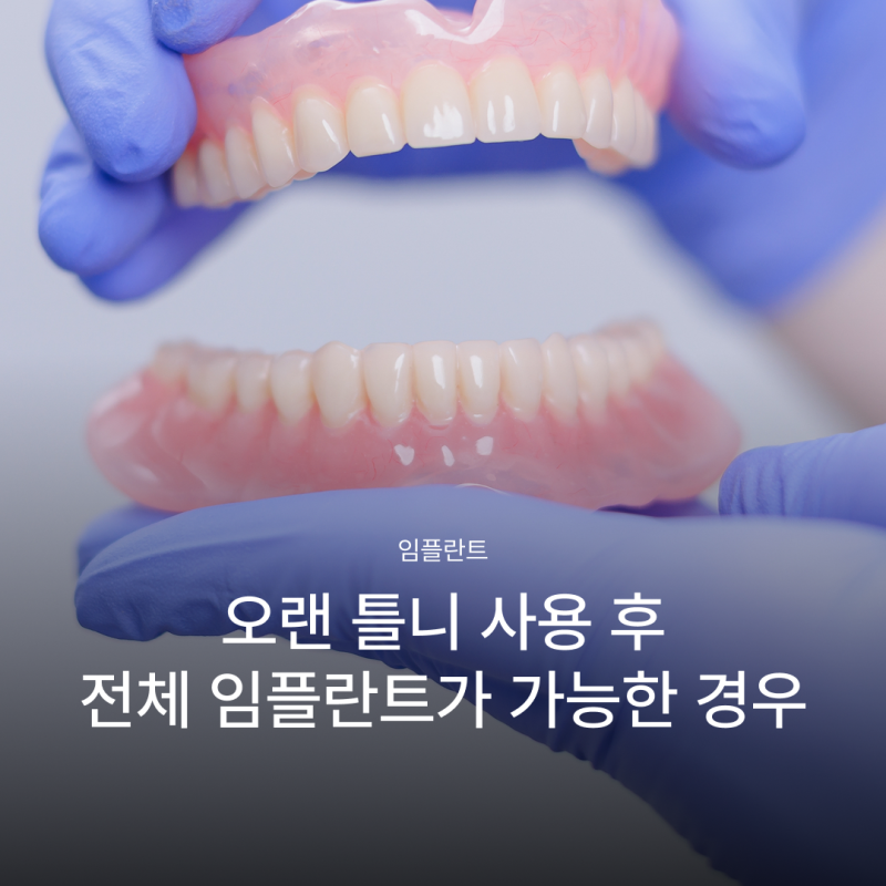 오랜 틀니 사용 후 전체 임플란트가 가능한 경우, 임플란트 종류와 전체 임플란트 뜻까지