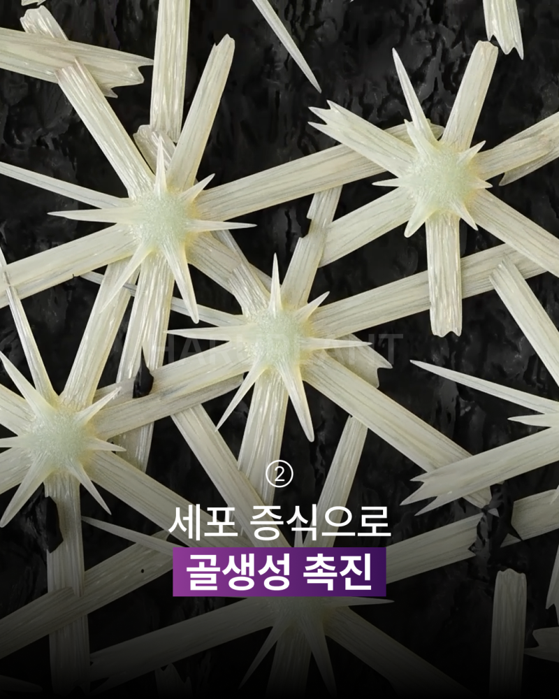 임플란트기간을 줄이고 싶다면? 빠른 회복으로 주목받는 플라즈마 임플란트, 후기까지 알아보세요! 사진 4