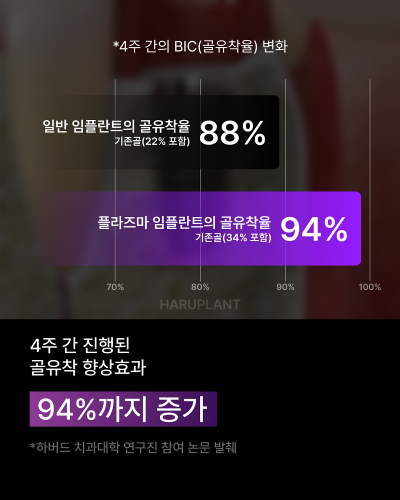 임플란트기간을 줄이고 싶다면? 빠른 회복으로 주목받는 플라즈마 임플란트, 후기까지 알아보세요! 사진 6