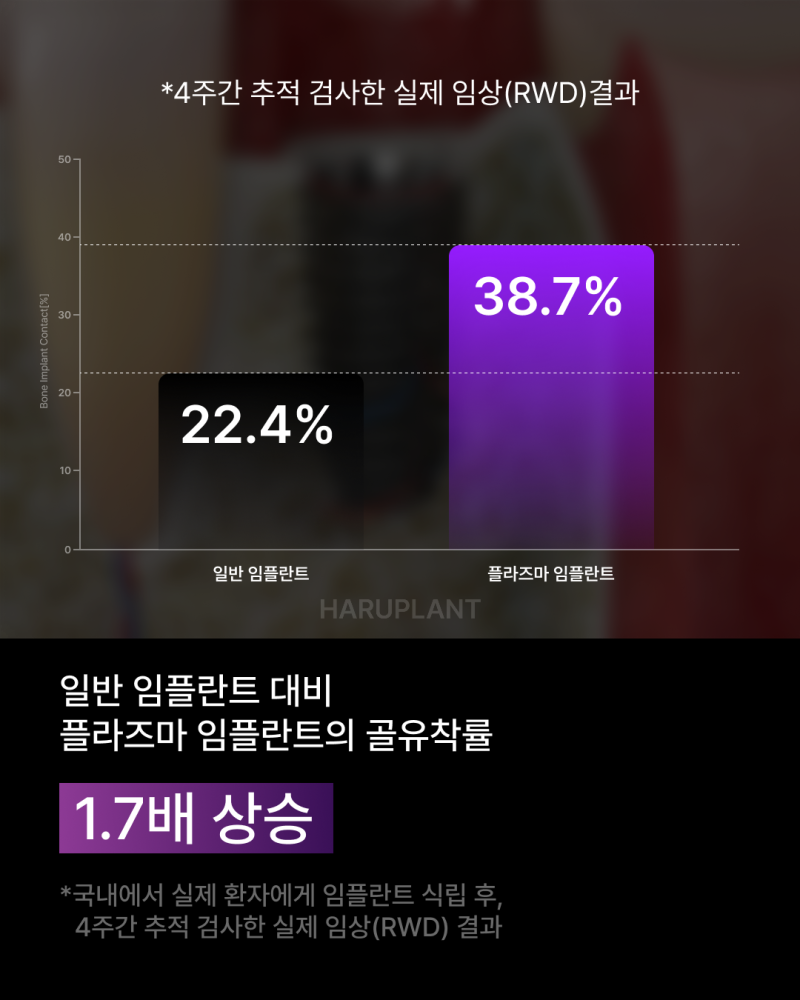 임플란트기간을 줄이고 싶다면? 빠른 회복으로 주목받는 플라즈마 임플란트, 후기까지 알아보세요! 사진 8